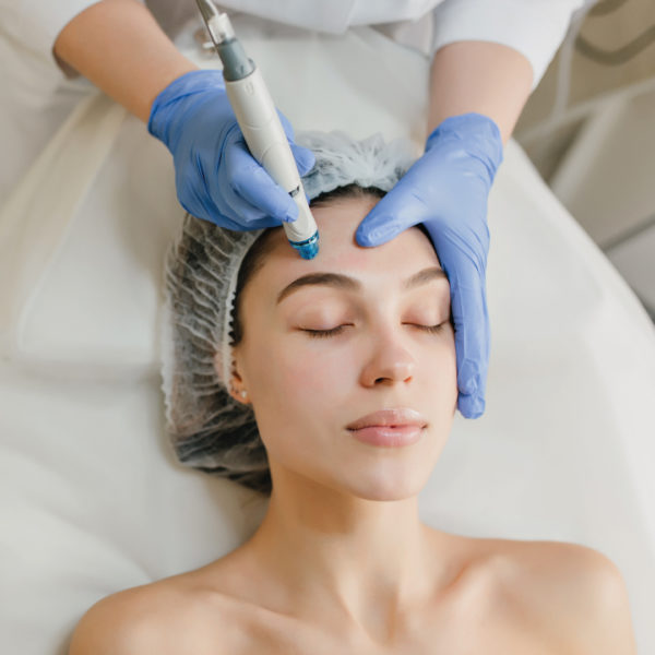 mujer jóven realizándose tratamiento facial microdermoabrasión